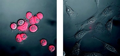 Nanopartículas iluminan las células cancerígenas más mortales en la sangre
